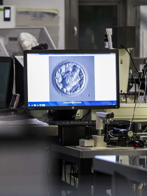 EMBRYOSCOPE
