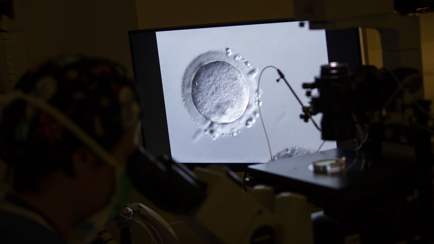 Transfert d'embryon congelé : conseils avant et après cette étape