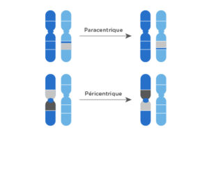 Inversions: elles résultent de la cassure d’un fragment de chromosome
