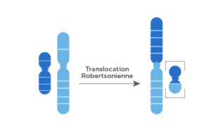 Anomalies chromosomiques de structure 3