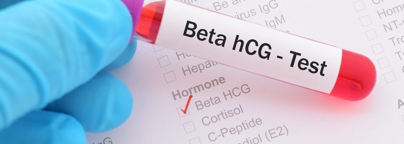 attente-beta-IVI-HCG