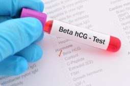 attente-beta-IVI-HCG
