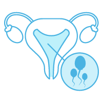 Il existe un processus de stimulation ovarienne à base de gonadotrophines qui consiste à obtenir le développement de plusieurs follicules ovariens. Cette méthode permet de contrôler la croissance et la maturation des follicules et d’augmenter ainsi les chances de grossesse. 