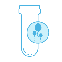 L’échantillon de sperme est traité en laboratoire de manière à sélectionner uniquement des spermatozoïdes suffisamment mobiles pour pouvoir féconder l’ovocyte.