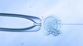 Fécondation in Vitro : 10 conseils pour bien vivre la ponction