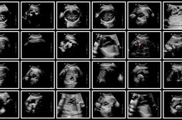 Quelle est la différence entre zygote, embryon et fœtus ?