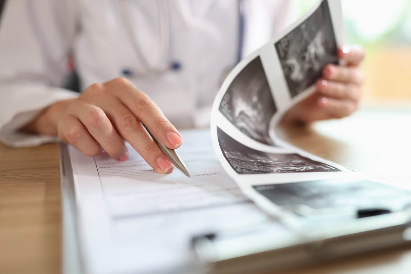 Malformations utérines : quelles conséquences sur la fertilité ?