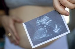 L’Intelligence Artificielle permet de prédire le battement fœtal grâce à l’étude de l’embryon dévitrifié
