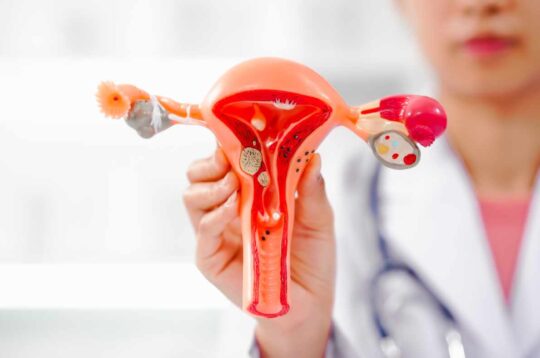 Myomes : symptômes et traitement