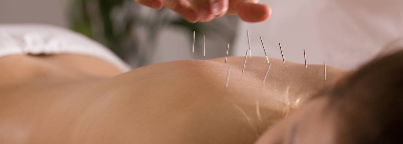 acupuncture fertilité